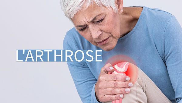 L’ARTHROSE : Arthrite, arthrose, ostéo-arthrite, polyarthrite rhumatoÏde…